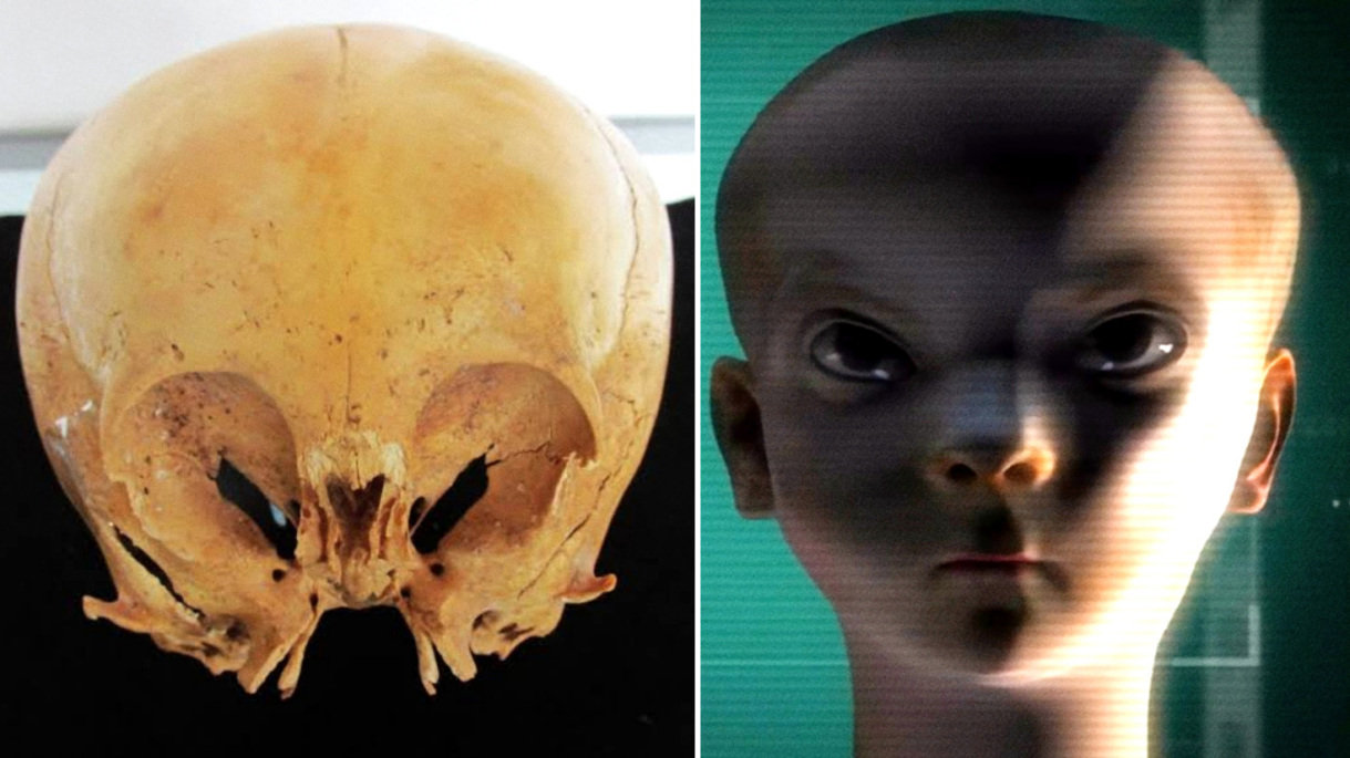 Starchild Skull: ต้นกำเนิดลึกลับของ Star Children 1