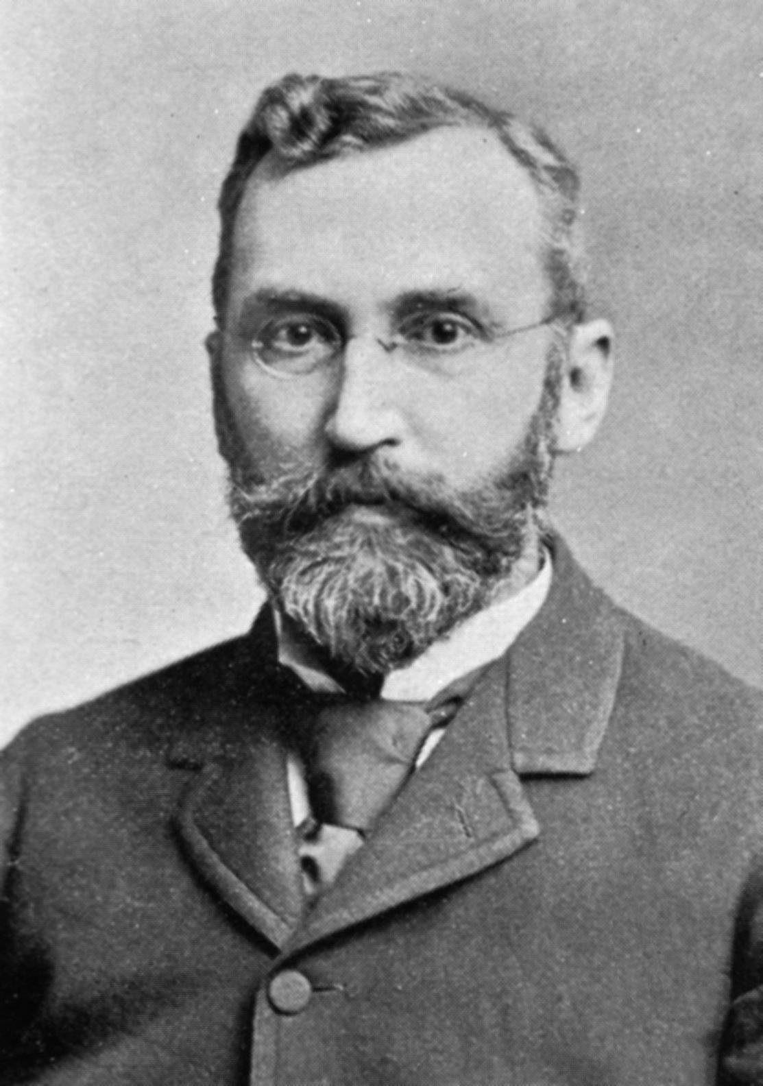Dr George M. Gould Edward Mordrake