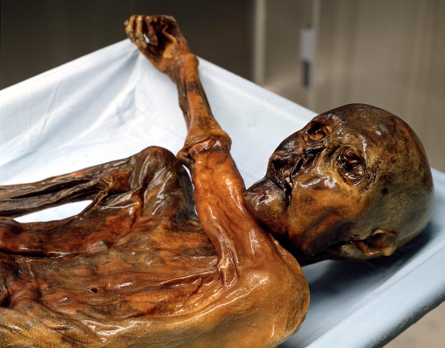 Ötzi Iceman