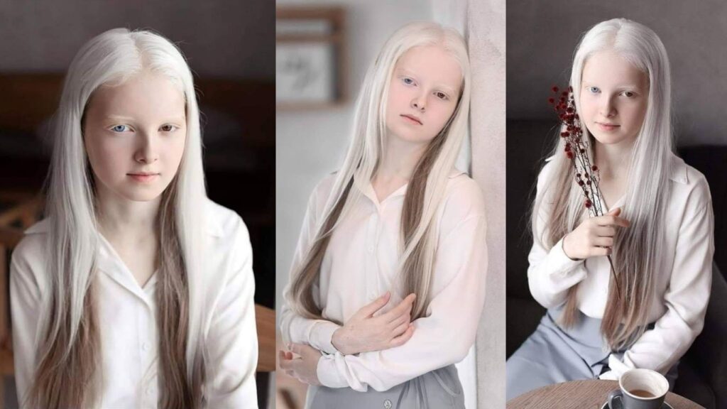 Amina Ependieva – una ragazza cecena ammirata per la sua insolita bellezza 8