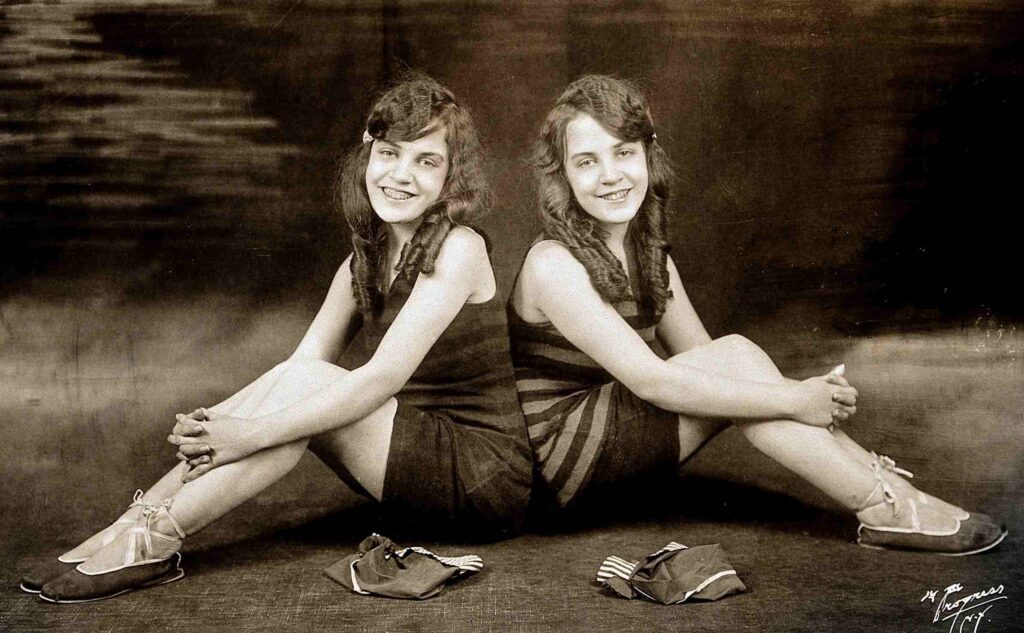 Daisy ja Violet Hilton, ühendatud kaksikud
