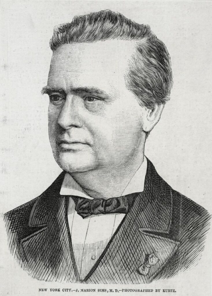 J. Marion Sims: The 'Father of Modern Gynecology'