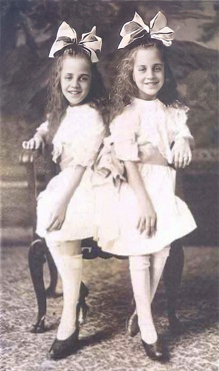Daisy ir Violet Hilton: neįtikėtina, širdį draskanti istorija apie sujungtus dvynius, kurie kartą sukrėtė pasaulį 1