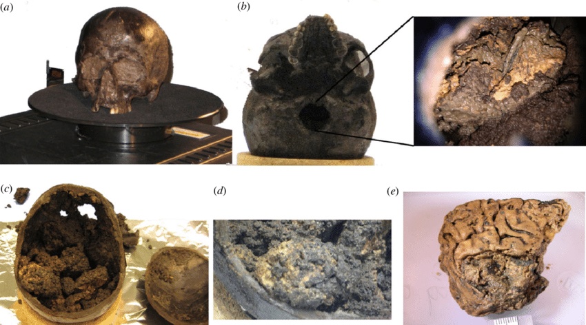 헤슬링턴 두뇌: 이 이상한 고대 인간 두뇌는 2,600년 동안 잘 보존되어 있었습니다 5
