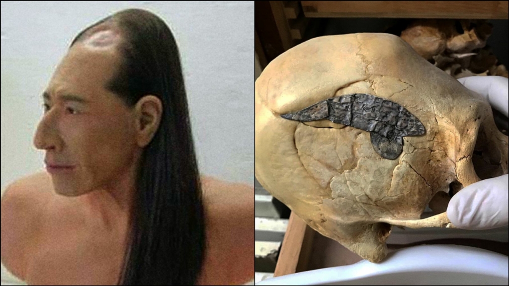 Crânio de 2,000 anos unido por metal