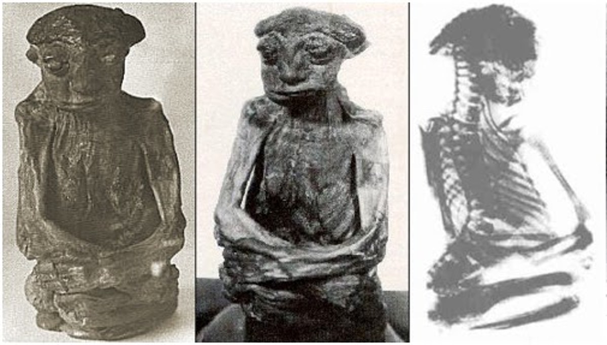 Ось кілька відомих фотографій та рентгенівських знімків мумії, знайденої в гірському хребті Сан-Педро