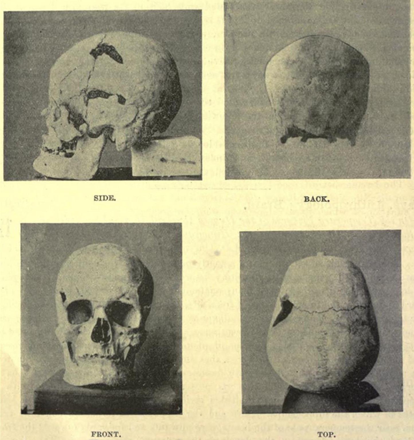 schedel van de oude Egyptische farao Sanakht