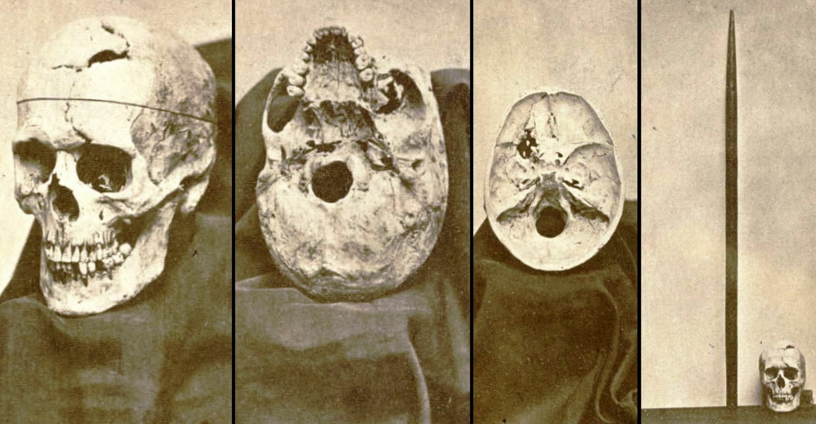 Деверот на Гејџ (службеник во градот Сан Франциско) и неговото семејство лично му ги предале черепот и железото на Гејџ на Харлоу.