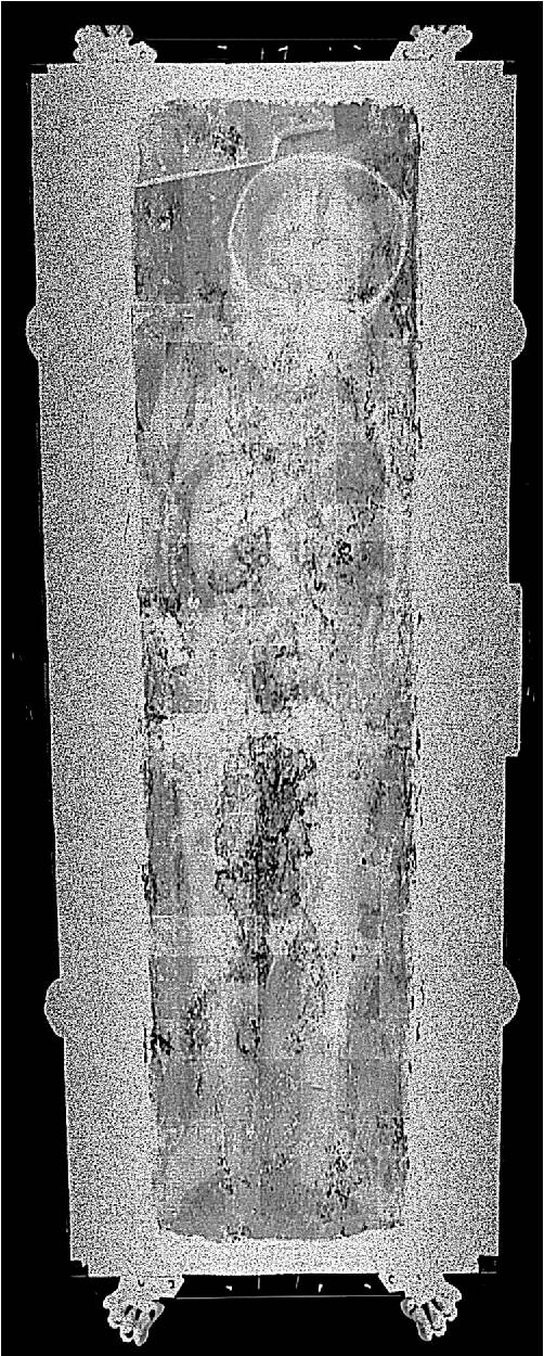 X-ray of Rosalia Lombardo 