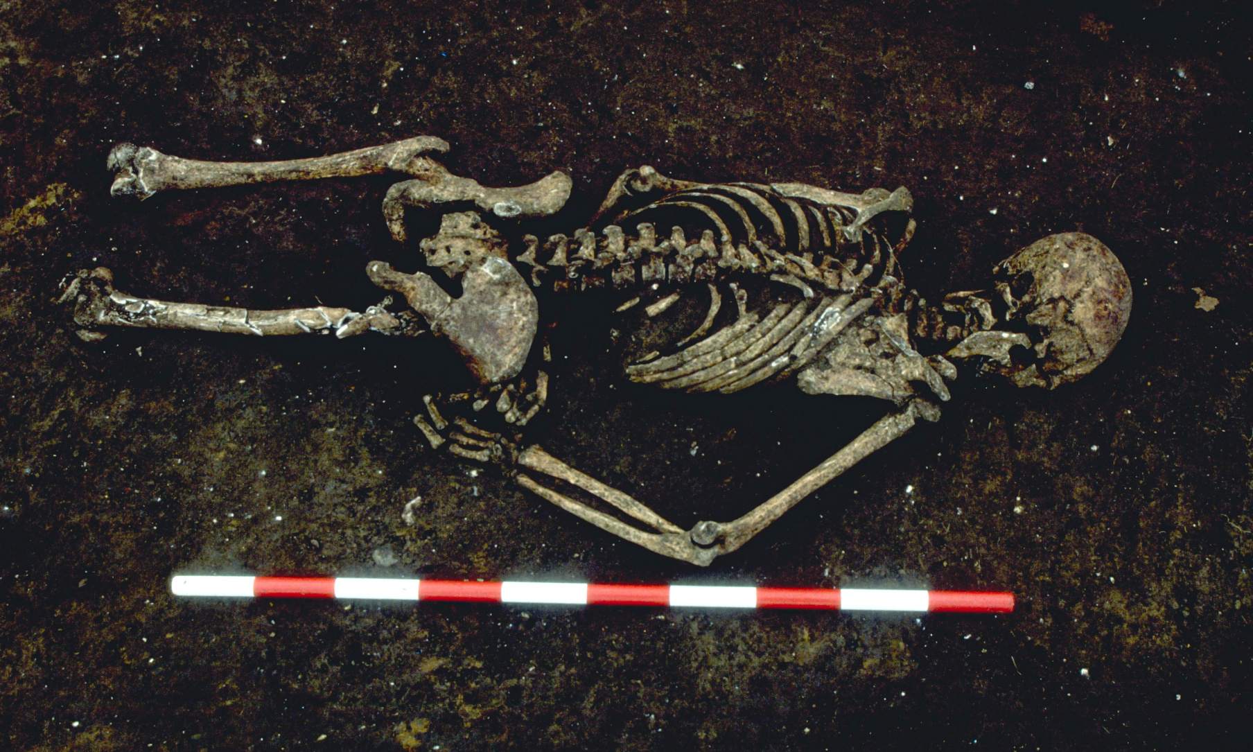 1,500 वर्षांचा सांगाडा उजवा हात असामान्य कोनात वाकलेला आढळला. त्याचा मृत्यू झाला तेव्हा त्याला बांधले गेले असावे, असे अभ्यास संशोधकांचे म्हणणे आहे. आधुनिक काळातील विकासामुळे त्याचे खालचे शरीर नष्ट झाले.