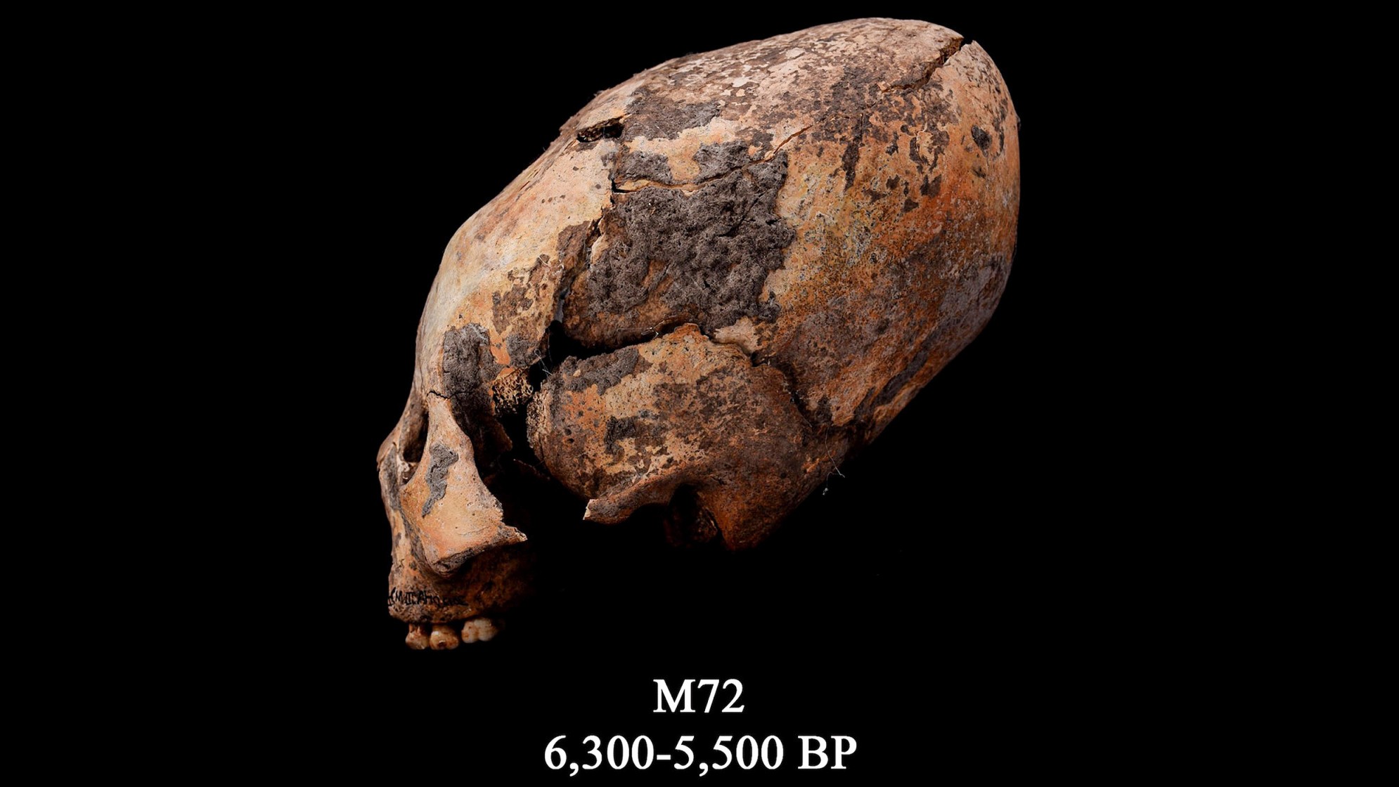M72として知られる頭骨。 この再形成された人間の頭蓋骨は、中国北東部で発見され、意図的に修正されました