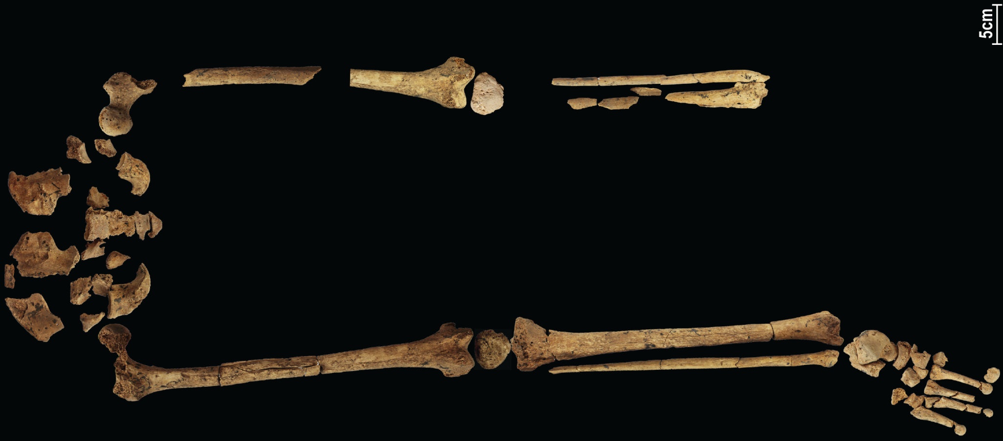 31,000 3 let stará kostra zobrazující nejstarší známou komplexní operaci by mohla přepsat historii! XNUMX