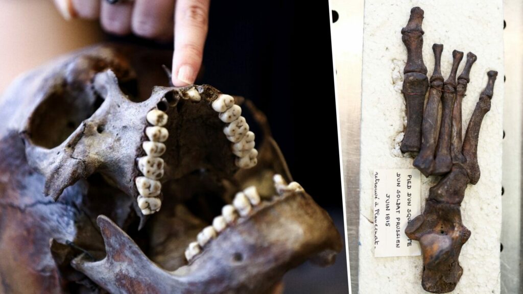 Le mystère vieux de deux siècles des restes squelettiques de Waterloo 4