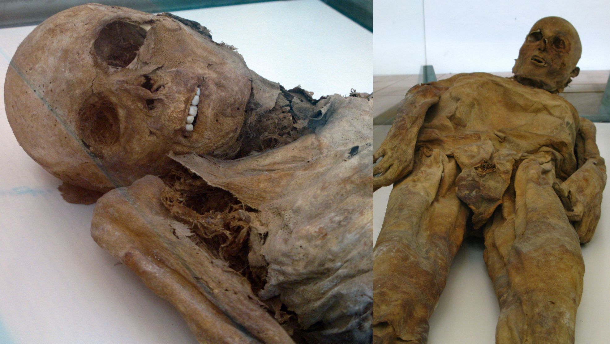 Dua dari mumi Venzone yang diawetkan dengan menyeramkan. Dengan dekomposisi normal, gigi cenderung rontok beberapa minggu setelah kematian.