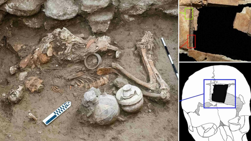 Arheoloogid avastavad hilispronksiajast pärit ajuoperatsioonide varaseid jälgi