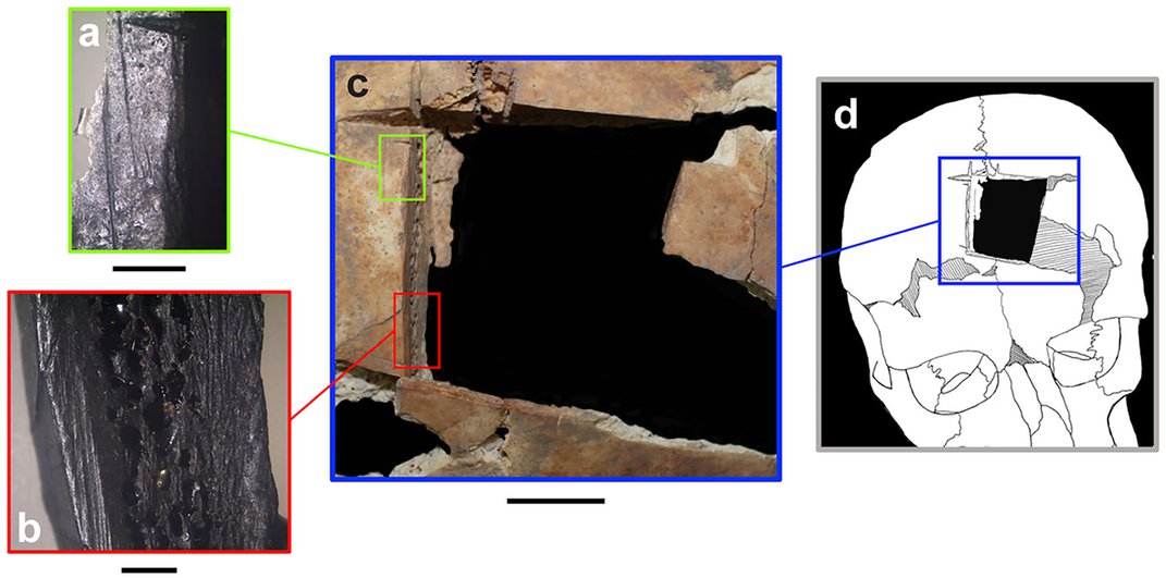 Археолозите откриваат рани траги од операција на мозокот од доцното бронзено доба 2
