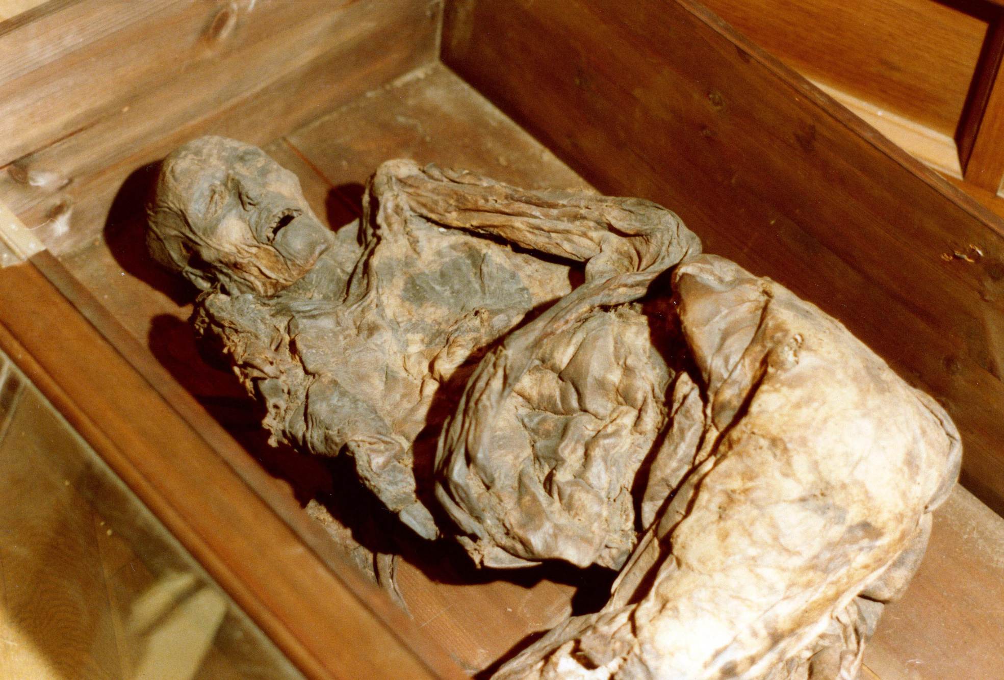 Corpul de mlaștină al femeii Huldremose