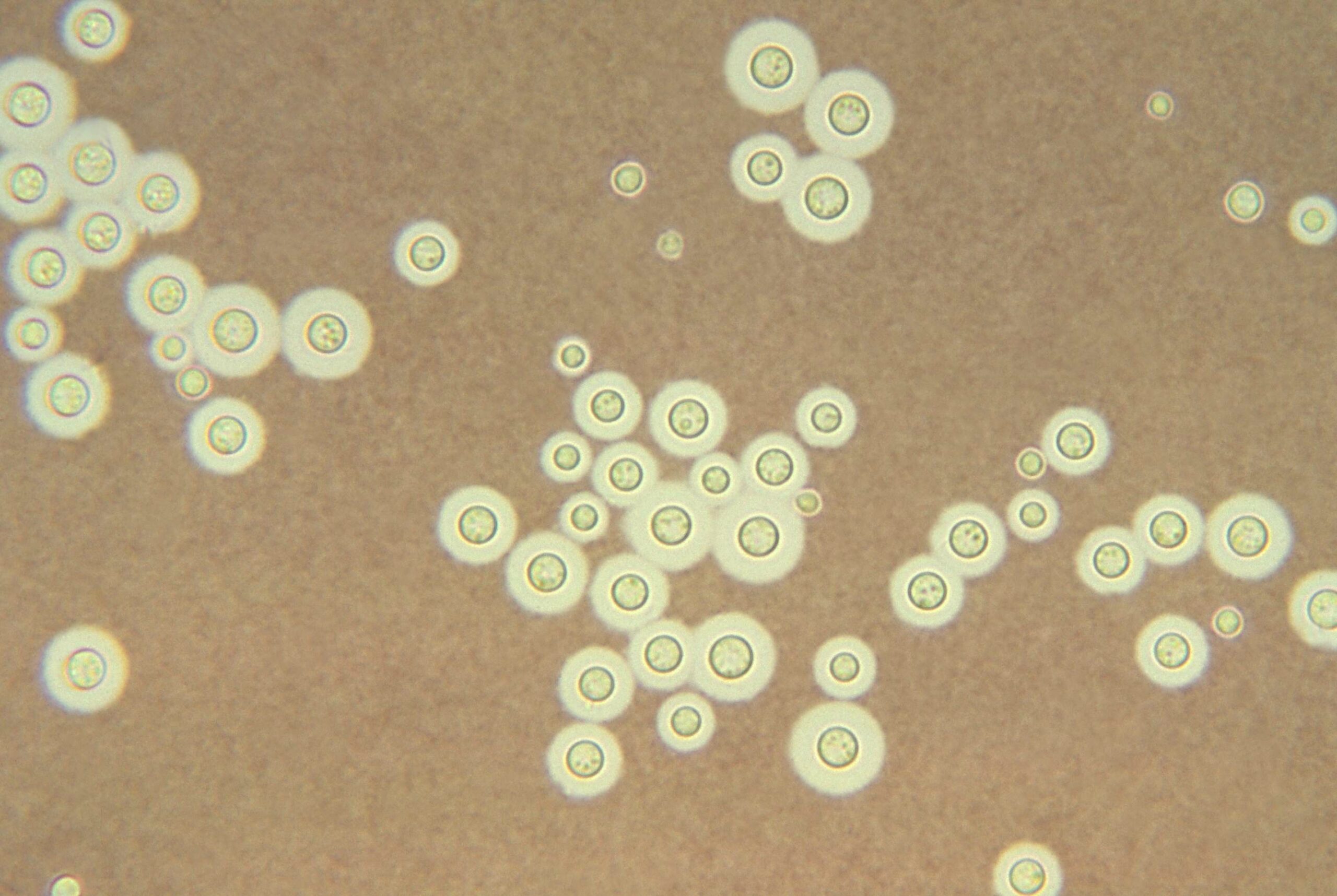 Champignons de Tchernobyl Cryptococcus neoformans