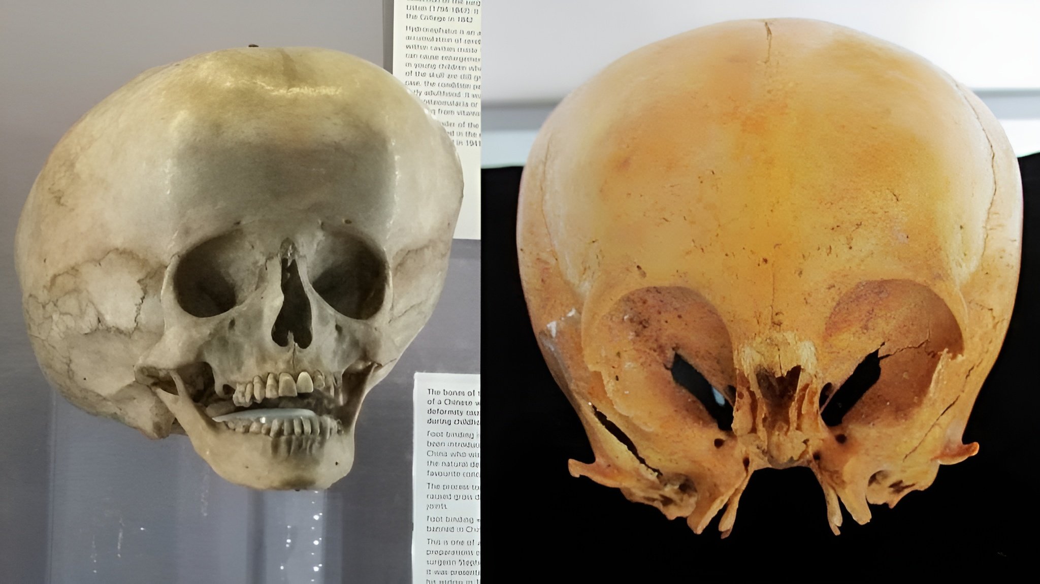 The mysterious origin of the Starchild Skull 1